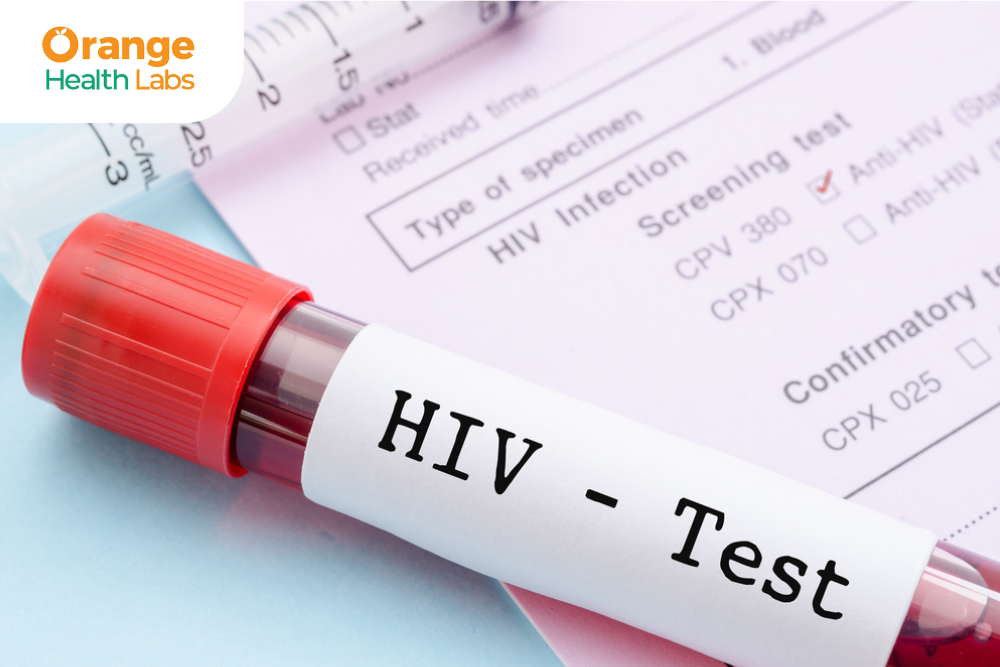 HIV Test Prevention and Treatment